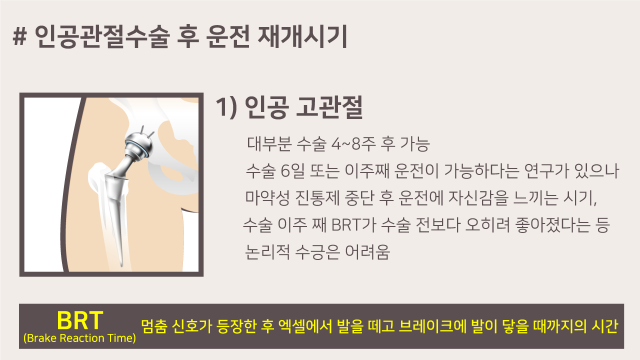 인공고관절.png