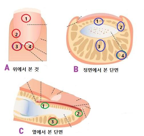 사구체종양_설명이미지_이충훈.jpg