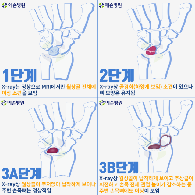 키앤백씨_수부외과전문병원_부천예손병원.png